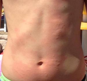 EFT e la Medusa “Elettrica” 